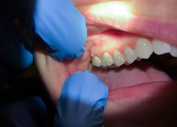 Best Emergency Gum Pain Relief  in Cave Junction, OR